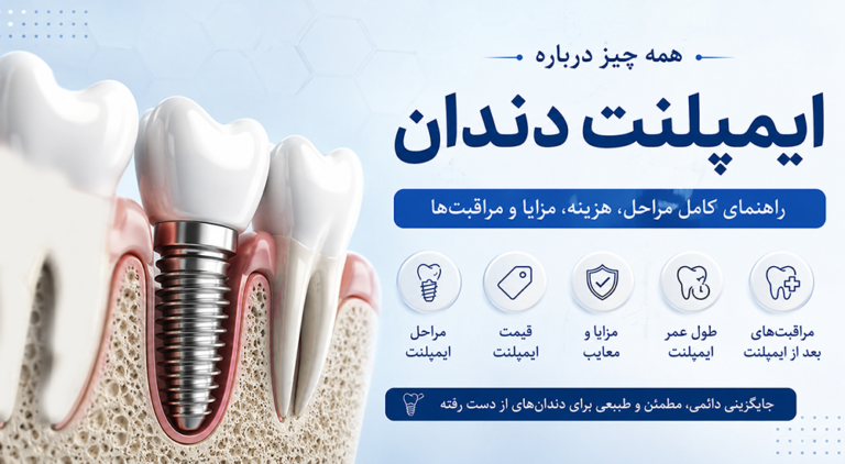 ایمپلت دندان چیست؟